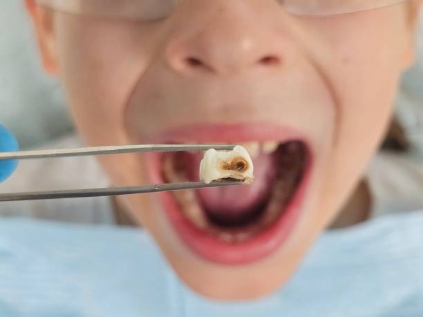 Best Dentist for Tooth Abscess  in Harmony, PA